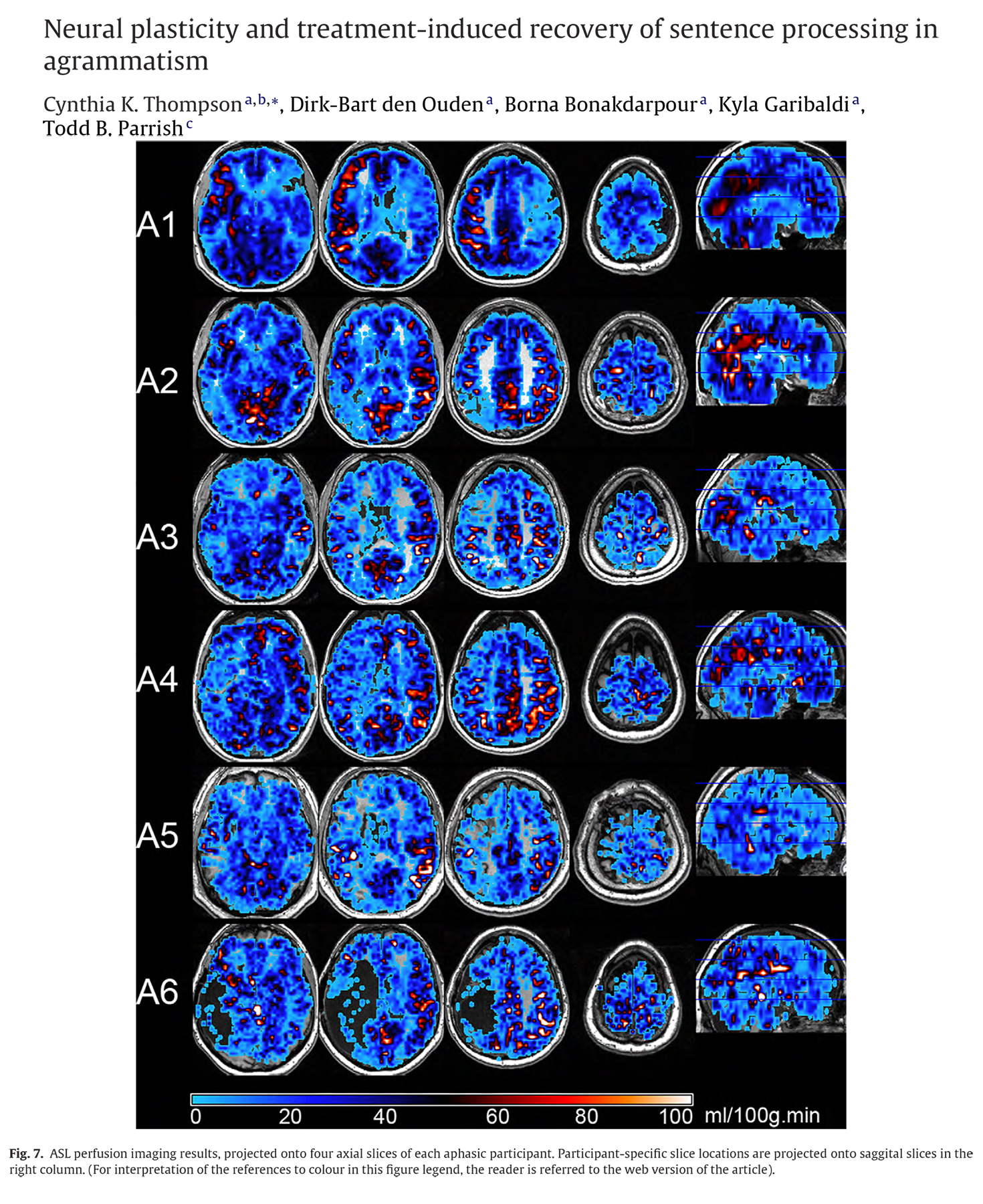 Neuropsychologia, 48 (2010) 3211-3227. 10.1016/j.neuropsychologia.2010.06.036